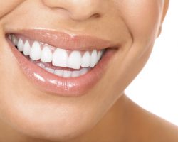 Healthy Beautiful Teeth | Dores Dental in East Longmeadow, MA Healthy Beautiful Teeth | Dores Dental in East Longmeadow, MA