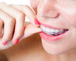Invisalign | Dores Dental - Longmeadow, MA Dentist Invisalign | Dores Dental - Longmeadow, MA Dentist