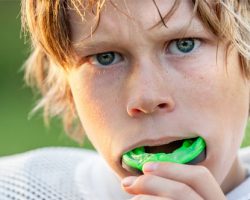 Mouthguards 1 | Dores Dental - East Longmeadow, MA