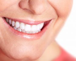 Teeth Whitening 1 | Dores Dental - East Longmeadow, MA