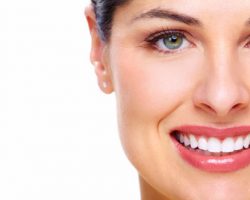 Teeth Whitening 2 | Dores Dental - East Longmeadow, MA