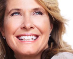 Dental Veneers 1 | Dores Dental - East Longmeadow, MA Dental Veneers 1 | Dores Dental - East Longmeadow, MA