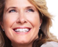 Dental Veneers 1 | Dores Dental - East Longmeadow, MA