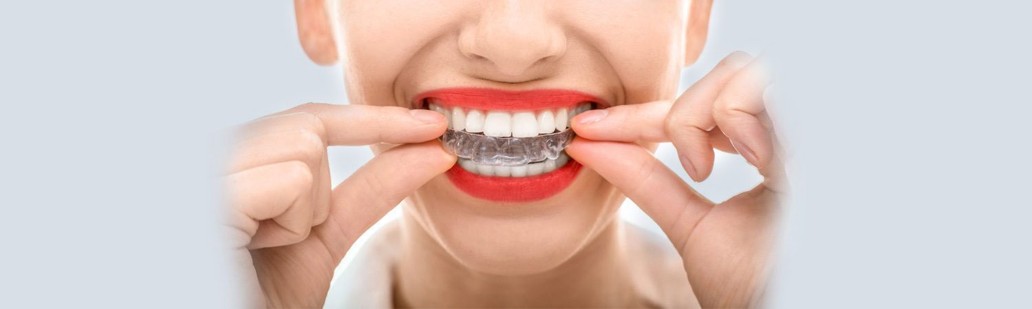Invisalign Orthodontics in East Longmeadow, MA | Dores Dental